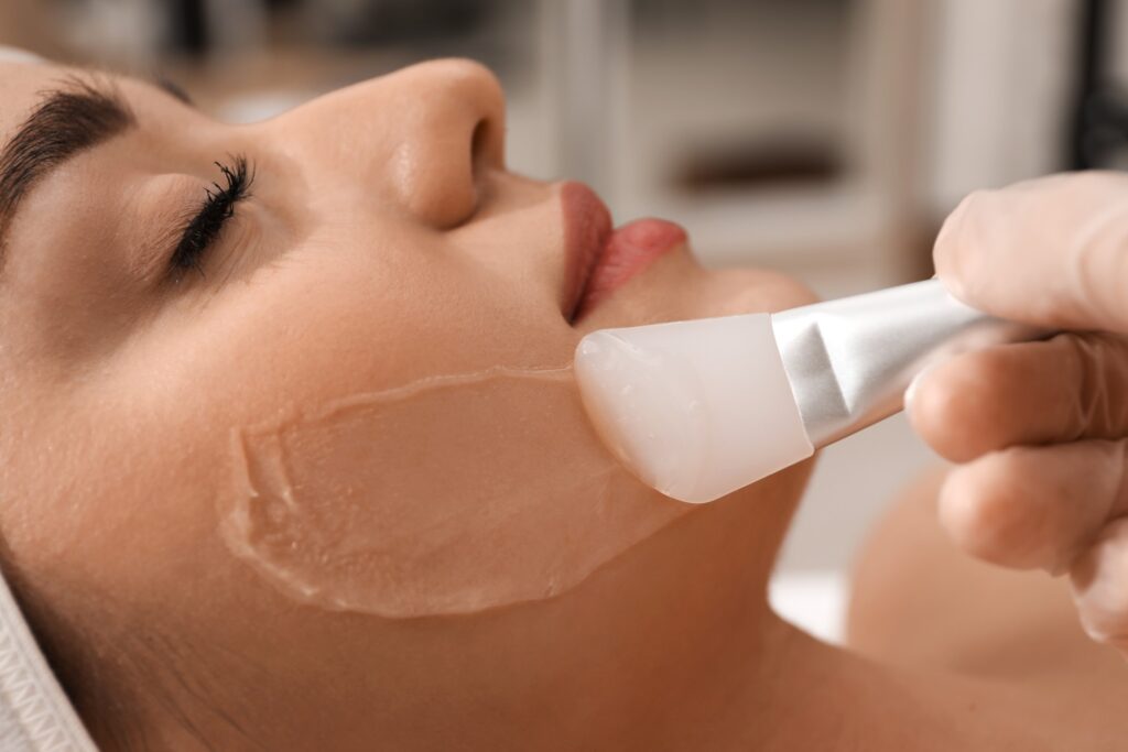 chemical peel